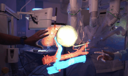 RAISE e la ricostruzione 3D degli organi: un progetto di Spoke 2 con l’ospedale San Martino di Genova