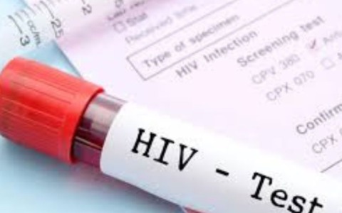 All’Informagiovani test per Hiv, epatite C  e sifilide
