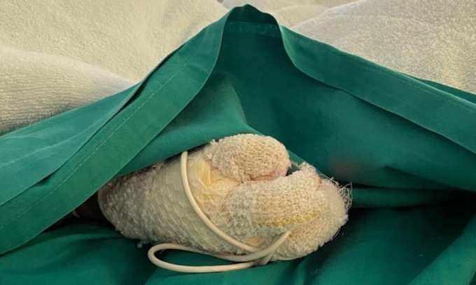 Bimbi ustionati nel falò all’asilo di Osio Sopra: fissate le udienze del processo a maestra e coordinatrice
