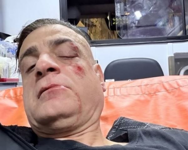 Lo youtuber ‘Cicalone’ aggredito alla fermata Ottaviano da 10 borseggiatori