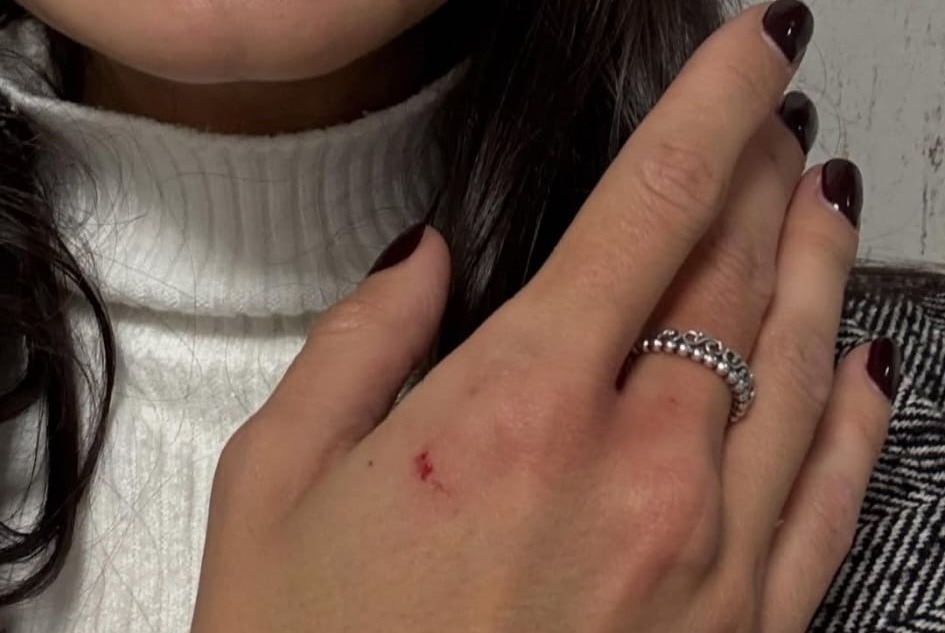 Rimpatriato con scorta internazionale il gambiano che aggredì la modella sul treno