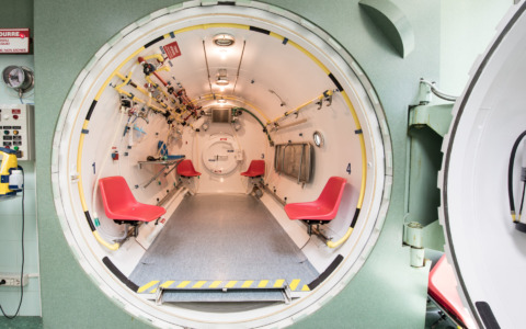 La caldaia funziona male, 87enne intossicata dal monossido