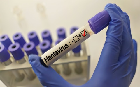 Hantavirus, turista britannico in quarantena al Sacco: negativo ai test