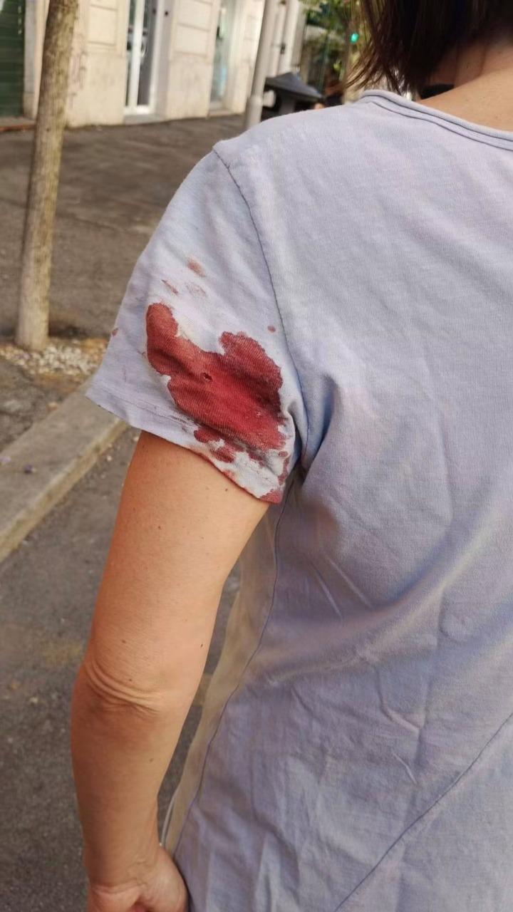 Donna ferita in via della Giuliana, emergono nuovi casi