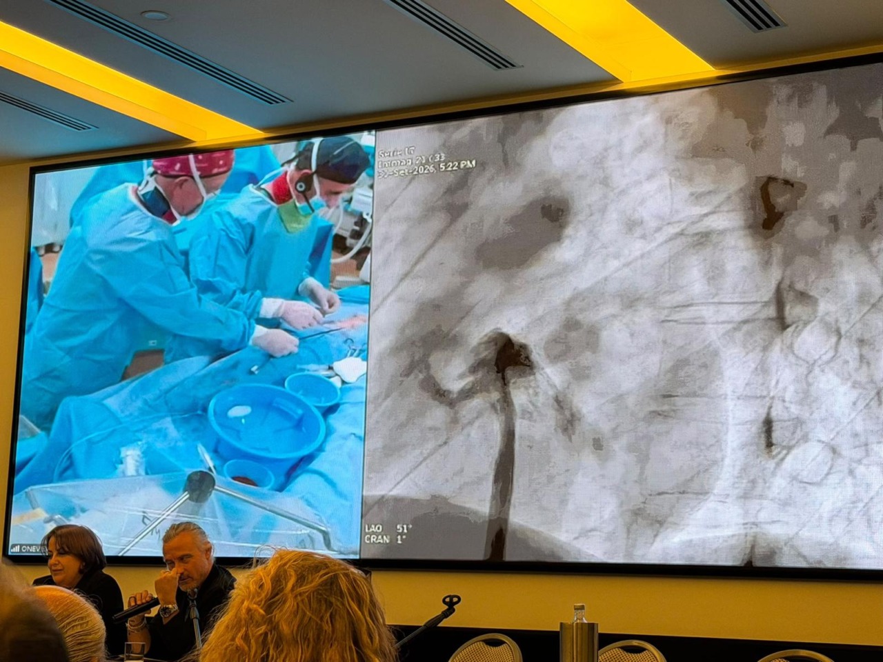 Cardiologia, il Goretti fa scuola nella chiusura del forame ovale pelvio